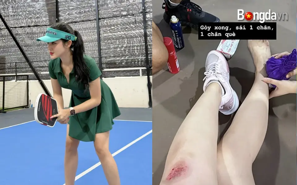 Á Hậu Huyền My Gặp Chấn Thương Bất Ngờ Khi Đánh Pickleball